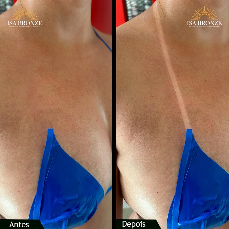 Bronzeamento a jato antes e depois​